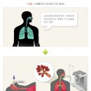 은혜요양병원 | 전주 요양병원 추천 폐렴 급성호홉곤란증후군 전주 연수 요양병원