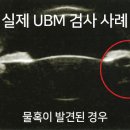 렌즈공간 이미지