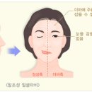 동백한의원 네이버블로그