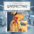 끌림 동물병원 | 강아지 십자인대 파열 CTWO 수술 이야기, 2개월차 회복 후기까지｜고양시 덕양구 삼송동 모리동물병원