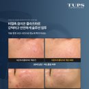 터치피부샵 이미지