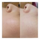 사바비안양주 | 사바비안 양주옥정점 무오일화장품 피부관리 리얼후기/옥정피부관리