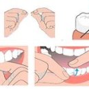 치아건강을 위해 꼭 챙겨야 하는 4가지 이미지