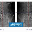 한양마디의원 네이버블로그