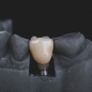 따뜻안치과의원 이미지