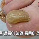 레푸스 화정점 이미지