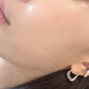 세포 | 홍대피부과 자가 줄기세포 뱀파이어주사 후기