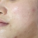GS25주월사랑점 | 광주 주월동 피부관리 VVS 무결점관리 물빛스킨케어와 함께