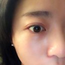 바데카실크림 각질제거크림 추천:: 피부가 아가같아짐ㅋㅋㅋㅋ