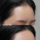 라티도헤어 | 헤어라인왁싱 잘하는 강북구 미아역왁싱 미아사거리왁싱 솔라티도왁싱 미아점