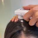 강남-168 | 강남두피 [WT메소드 클래시 압구정점] | 수부지 두피 진단과 스케일링 만족 후기