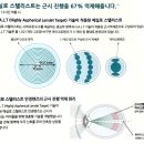 대학병원안경 이미지