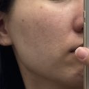 세은화장품 | 셀라딕스 131앰플 인생템 되어버린 후기