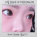 심외과의원 | 서울 강남 코성형 상담 후기 자가늑으로 유명한 성형외과 상담 다녀왔어요