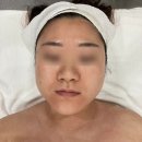 울산피부관리 톤,결,광 한번에 가능한VVS 관리는 아르케스킨앤바디