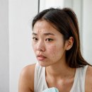 꿀C | 순수비타민C 앰플 부작용 없는 제품 추천받아 쓴 2달 후기