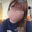 현하윤헤어라인 이미지