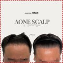 에이원헤어라인 이미지