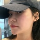 화이트성형외과의원 | 플레저성형외과 튠팡페이스 솔직 후기