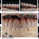 U 치과기공소 이미지