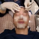 브이맨비뇨기과의원 | 잠실피부과 색소침착관리 2회차 후기(feat.엑셀브이레이저후기)