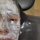 늘샤인 의원 | 분당 피부과 늘샤인의원 리쥬란힐러, 스킨보톡스 내돈내산 찐후기(feat.인모드, 레이저토닝)