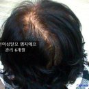 고운빛헤어샵 | 조금이라도 나아질 수 있기를 기대하며.. 관리후기 3탄 , 평소 일반 펌에서 관리후 열펌 시술이 가능해...
