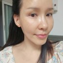 레이져 시술후 재생크림 추천 병원 화장품 피부과 재생크림 흑자제거후 바르는 재생크림