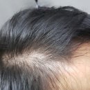 한미모뷰티 네이버블로그