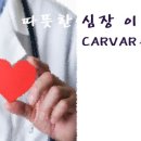 송명근교수의 carvar수술 탄생 연혁 이미지