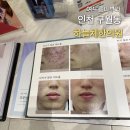 황금한의원 | 인천여드름피부과 하늘체한의원 웨딩관리 성인여드름 청소년여드름