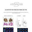 체정한의원 | 온코써미아에 의한 흑색종 폐 전이병변 성장 억제