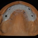 엘리트치과기공소 이미지