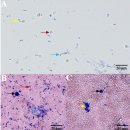 참게 milky disease원인 효모 Metschnikowia bicuspidata의 형태 이미지