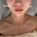 당신의공간 | 천안 불당동 윤곽관리 잘하는 곳 당신의 얼굴형 프로젝트 후기