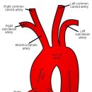 George&#39;s vertebral artery test 이미지