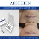 애프터메디 이미지