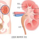 급성 만성 신우신염 원인 방법 이미지