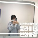 행복한외과병원 | 요즘 많이 한다는 튠라이너, 신논현역성형외과에서 받아본 솔직 후기