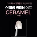 세라치과기공소 네이버블로그