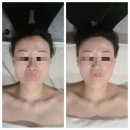 선피부관리 - 양평군 | 과천피부관리 선에스테스파 과천점 윤곽관리 후기 웨딩케어로 추천