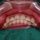 치아룸 치과기공소 이미지