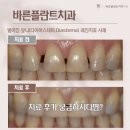 우림치과의원 네이버블로그