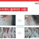 머리엔머리