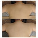의정부붓기관리, 다이어트, 림프순환, 통증관리를 한번에 해주는 대단한몸매 행복로점 2회 관리 후기