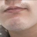 송준호레이메디