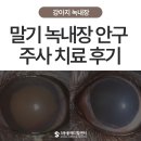 포항축협동물병원 | 주사 치료법과 치료 후기 – 겐타마이신 vs 시도포비어 비교 - 울산·포항·경주 안과 전문 동물병원