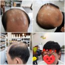 김호증모 by에스헤어샵 / 추천 구미 가발