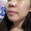 [코골이밴드/비염환자코확장밴드] 코빵밴드, Breath Right 코밴드 착용 후 수면 질 상승 솔직 후기!