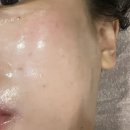 새롬메디 | 브이라인 찾아주는 신중동 피부관리샵 찐 재방문 후기 아우슈라메디에스테틱